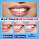 KIT BLANQUEAMIENTO DENTAL EN CASA